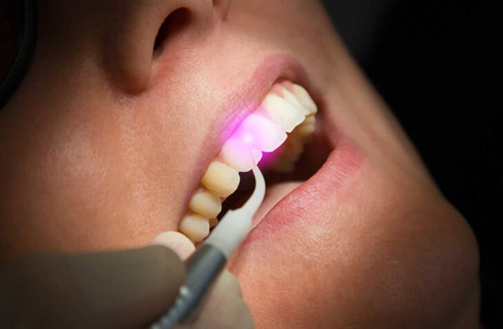 Painless Dental Treatment In Mahim